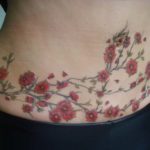 Abdominoplastia-tatuagem-01