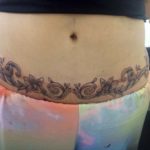 Abdominoplastia-tatuagem-03