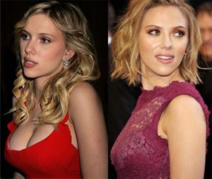 Scarlett Johansson antes e depois da redução de mama