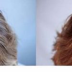 Fototerapia capilar antes e depois